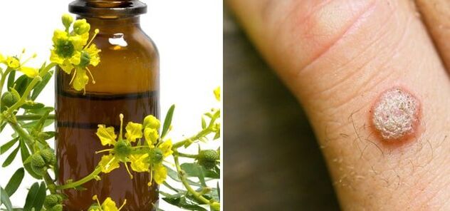 treatment of warts with pharmaceutical celandine